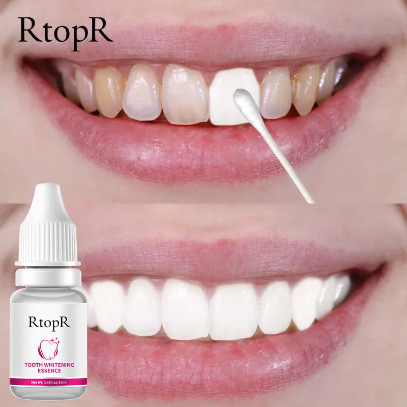 RtopR Teeth Whitening Essence Brighten Teeth Remove Plaque Oral Hygiene Fresh Breath Clean Mouth Bleach Teeth Dental Care Tools