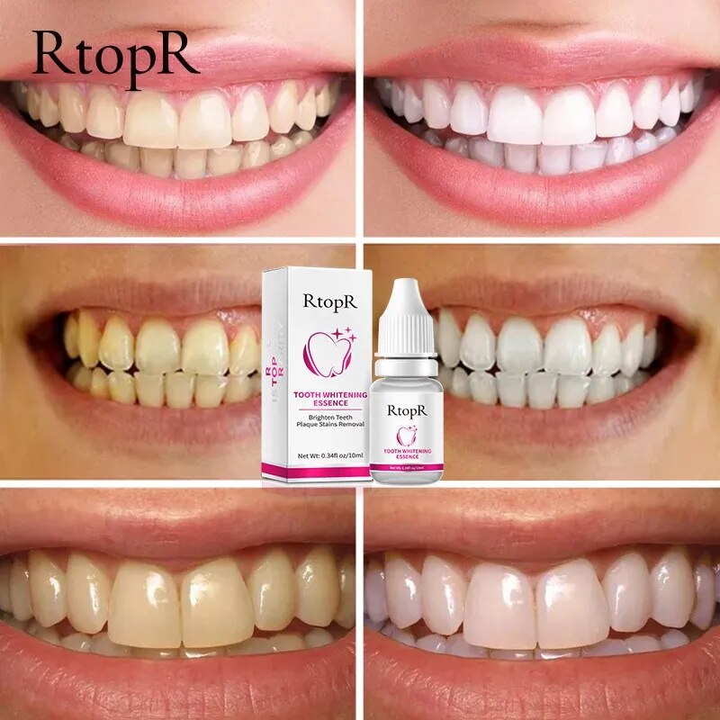 RtopR Teeth Whitening Essence Brighten Teeth Remove Plaque Oral Hygiene Fresh Breath Clean Mouth Bleach Teeth Dental Care Tools